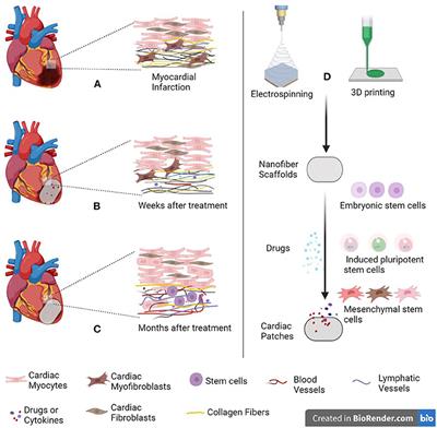 New Forms of Electrospun Nanofibers Applied in Cardiovascular Field